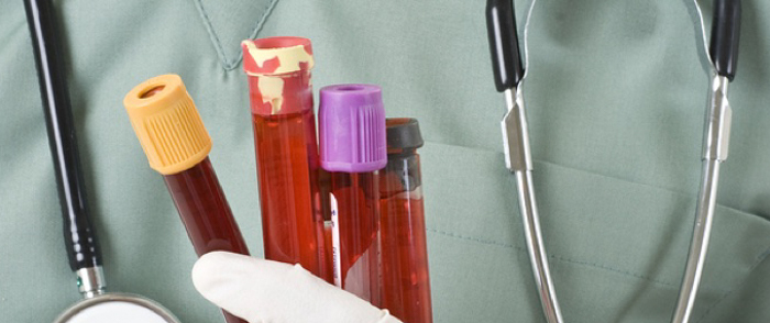 Drug Testing and Marijuana Legalization Employment Drug Testing