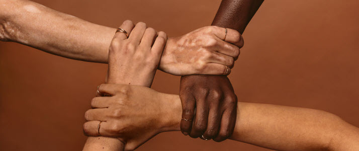 arms and hands of different skin colors overlapping